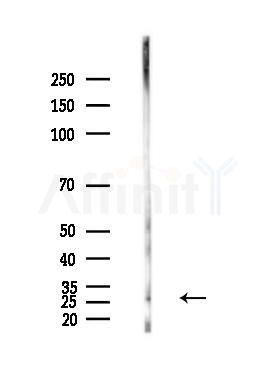 ERAB Antibody - Western blot analysis of lysates from Hela cells(heat-shock,45min treatment), using ERAB Antibody at 1/1000 dilution.