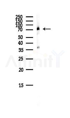FOXP4 Antibody - Western blot analysis of lysates from Mouse brain, using FOXP4 Antibody at 1/1000 dilution.