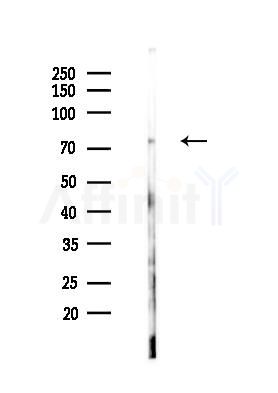 MAP2 Antibody - Western blot analysis of lysates from Hela cells(heat-shock,45min treatment), using MAP2 Antibody at 1/1000 dilution.