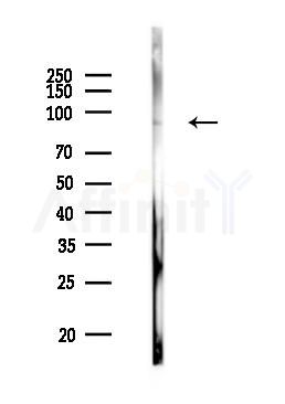 FOXP1 Antibody - Western blot analysis of lysates from Rat lung, using FOXP1 Antibody at 1/1000 dilution.