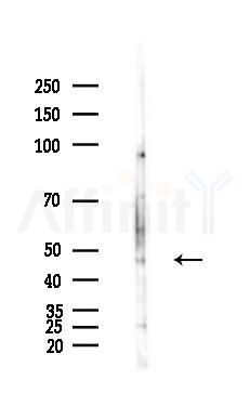 b-Enolase Antibody - Western blot analysis of lysates from Hela cells(heat-shock,45min treatment), using b-Enolase Antibody at 1/1000 dilution.