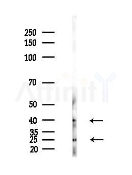 SCF Antibody - Western blot analysis of lysates from PC12 cells(LPS,4h treatment), using SCF Antibody at 1/1000 dilution.