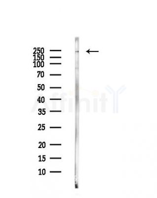 Phospho-BRG1 (Ser610) Antibody - Western blot analysis of lysates from Hela cells(heat-shock,45min treatment), using Phospho-BRG1 (Ser610) Antibody at 1/1000 dilution.