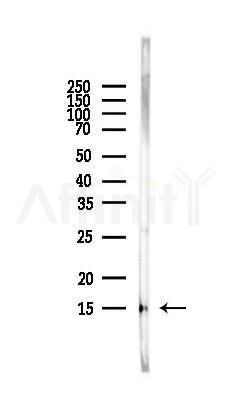 Acetyl-Histone H2A (Lys5) Antibody - Western blot analysis of lysates from Rat liver, using Acetyl-Histone H2A (Lys5) Antibody at 1/1000 dilution.