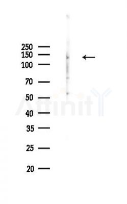 Phospho-EPHA4 (Tyr602) Antibody - Western blot analysis of lysates from K562 cells(UV,30min treatment), using Phospho-EPHA4 (Tyr602) Antibody at 1/1000 dilution.