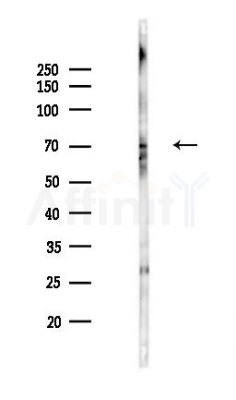 Phospho-IRAK3 (Ser510) Antibody - Western blot analysis of lysates from Hela cells(LPS,4h treatment), using Phospho-IRAK3 (Ser510) Antibody at 1/1000 dilution.
