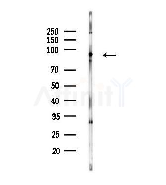 Phospho-Ku80 (Ser145) Antibody - Western blot analysis of lysates from MCF7 cells(heat-shock,45min treatment), using Phospho-Ku80 (Ser145) Antibody at 1/1000 dilution.