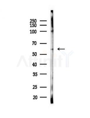 Phospho-AKT1 (Ser124) Antibody - Western blot analysis of lysates from PC12 cells(heat-shock,45min treatment), using Phospho-AKT1 (Ser124) Antibody at 1/1000 dilution.