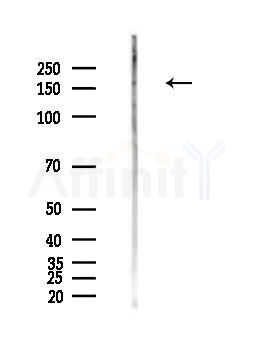 Phospho-IRS1 (Tyr896) Antibody - Western blot analysis of lysates from PC12 cells(LPS,4h treatment), using Phospho-IRS1 (Tyr896) Antibody at 1/1000 dilution.