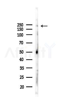 Phospho-VEGFR2 (Tyr1175) Antibody - Western blot analysis of lysates from Hela cells(starvation,24h treatment), using Phospho-VEGFR2 (Tyr1175) Antibody at 1/1000 dilution.