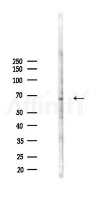 Phospho-IRAK1 (Thr387) Antibody - Western blot analysis of lysates from HepG2 cells(heat-shock,45min treatment), using Phospho-IRAK1 (Thr387) Antibody at 1/1000 dilution.