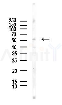 Phospho-PTEN (Ser380+Thr382+Thr383) Antibody - Western blot analysis of lysates from HUVEC cells(LPS, 4h treatment), using Phospho-PTEN (Ser380+Thr382+Thr383) Antibody at 1/1000 dilution.