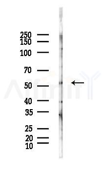 Phospho-PTEN (Ser380+Thr382+Thr383) Antibody - Western blot analysis of lysates from Hela cells(LPS, 4h treatment), using Phospho-PTEN (Ser380+Thr382+Thr383) Antibody at 1/1000 dilution.