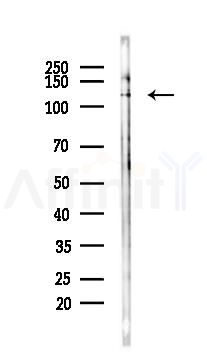 Phospho-RapGEF1 (Thr1071) Antibody - Western blot analysis of lysates from K562 cells(UV, 30min treatment), using Phospho-RapGEF1 (Thr1071) Antibody at 1/1000 dilution.