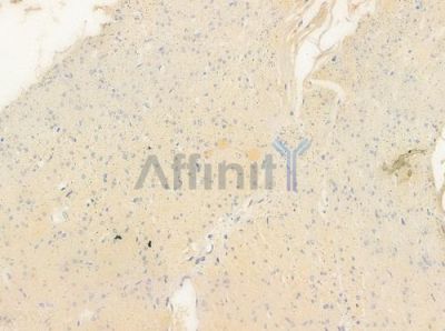 Phospho-Scribble (Ser1220) Antibody - AF4471 at 1/100 staining human normal colon tissue by IHC-P.