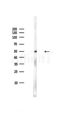 Phospho-PAR4 (Thr163) Antibody - Western blot analysis of lysates from PC12 cells, using Phospho-PAR4 (Thr163) Antibody at 1/1000 dilution.