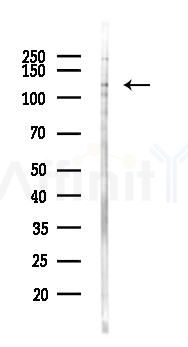 Phospho-NEDD4L (Ser342)  Antibody - Western blot analysis of lysates from HUVEC cells(UV, 30min treatment), using Phospho-NEDD4L (Ser342)  Antibody at 1/1000 dilution.