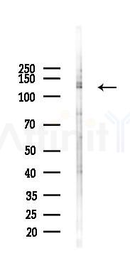 Phospho-NEDD4L (Ser342)  Antibody - Western blot analysis of lysates from K562 cells(UV, 30min treatment), using Phospho-NEDD4L (Ser342)  Antibody at 1/1000 dilution.