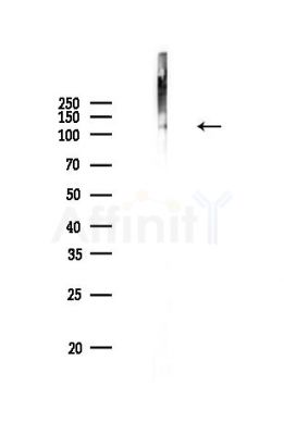 Phospho-CARD11 (Ser652) Antibody - Western blot analysis of lysates from HUVEC cells, using Phospho-CARD11 (Ser652) Antibody at 1/1000 dilution.