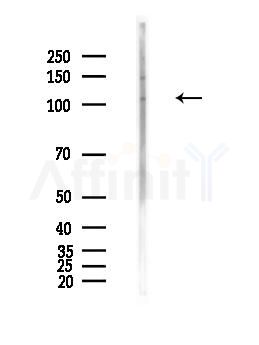 MRIP Antibody - Western blot analysis of lysates from PC12 cells(LPS,4h treatment), using MRIP Antibody at 1/1000 dilution.