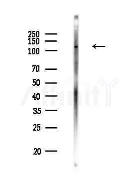 MRIP Antibody - Western blot analysis of lysates from Rat lung, using MRIP Antibody at 1/1000 dilution.