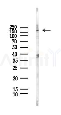 TSC1 Antibody - Western blot analysis of lysates from HUVEC cells(LPS, 4h treatment), using TSC1 Antibody at 1/1000 dilution.