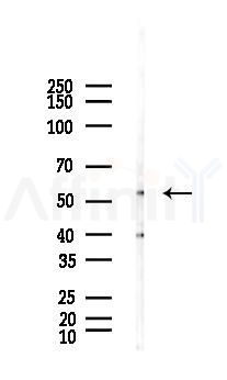 STK3 Antibody - Western blot analysis of lysates from Hela cells(LPS, 4h treatment), using STK3 Antibody at 1/1000 dilution.