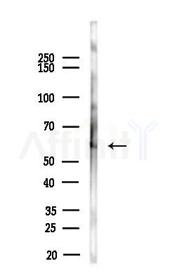 PHGDH Antibody - Western blot analysis of lysates from Mouse testis, using PHGDH Antibody at 1/1000 dilution.
