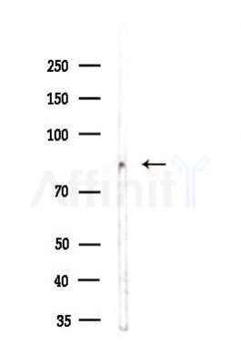 SLP76 Antibody - Western blot analysis of lysates from A2780 cells, using SLP76 Antibody at 1/1000 dilution.