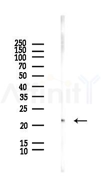 SAR1A Antibody - Western blot analysis of lysates from HUVEC cells(LPS, 4h treatment), using SAR1A Antibody at 1/1000 dilution.