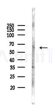 PPARD Antibody - Western blot analysis of lysates from Mouse lung, using PPARD Antibody at 1/1000 dilution.