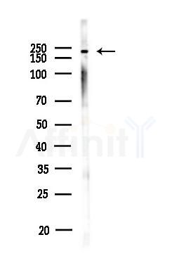 BRG1 Antibody - Western blot analysis of lysates from PC12 cells, using BRG1 Antibody at 1/1000 dilution.