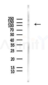 KSR1 Antibody - Western blot analysis of lysates from HUVEC cells(LPS, 4h treatment), using KSR1 Antibody at 1/1000 dilution.