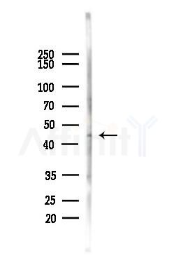 CD32 Antibody - Western blot analysis of lysates from EC304 cells(heat-shock,45min treatment), using CD32 Antibody at 1/1000 dilution.