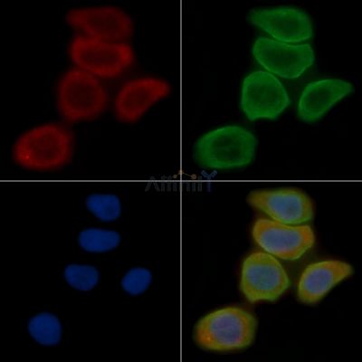 LC3B Antibody - AF4650 staining Hela cells(30min of UV treatment) by IF/ICC.