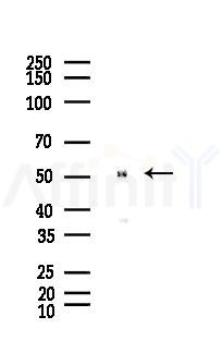 alpha Tubulin Antibody - Western blot analysis of lysates from Hela cells(LPS, 4h treatment), using alpha Tubulin Antibody at 1/1000 dilution.