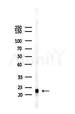 SOD2/MnSOD Antibody - Western blot analysis of lysates from EC304 cells(heat-shock,45min treatment), using SOD2/MnSOD Antibody at 1/1000 dilution.