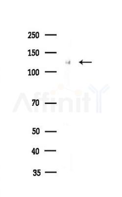 ATP citrate lyase Antibody - Western blot analysis of lysates from A2780 cells, using ATP citrate lyase Antibody at 1/1000 dilution.