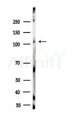 PIK3CA Antibody - Western blot analysis of lysates from A2780 cells, using PIK3CA Antibody at 1/1000 dilution.