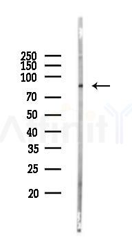 PI3K p85 alpha Antibody - Western blot analysis of lysates from Mouse lung, using PI3K p85 alpha Antibody at 1/1000 dilution.