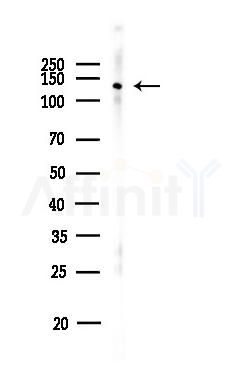 EPHA4 Antibody - Western blot analysis of lysates from PC12 cells, using EPHA4 Antibody at 1/1000 dilution.