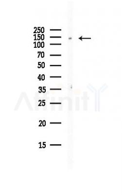 AS160 Antibody - Western blot analysis of lysates from HepG2 cells(LPS, 4h treatment), using AS160 Antibody at 1/1000 dilution.