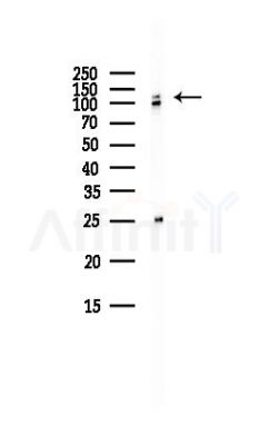 Catenin-1 Antibody - Western blot analysis of lysates from HepG2 cells(LPS, 4h treatment), using Catenin-1 Antibody at 1/1000 dilution.