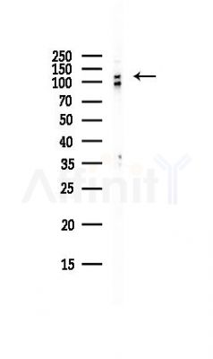 Catenin-1 Antibody - Western blot analysis of lysates from HepG2 cells(LPS, 4h treatment), using Catenin-1 Antibody at 1/1000 dilution.