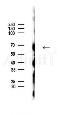 PFKFB2 Antibody - Western blot analysis of lysates from HUVEC cells(LPS,4h treatment), using PFKFB2 Antibody at 1/1000 dilution.