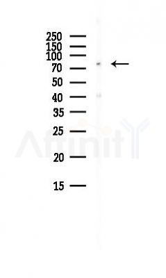Rad17 Antibody - Western blot analysis of lysates from HepG2 cells(LPS, 4h treatment), using Rad17 Antibody at 1/1000 dilution.