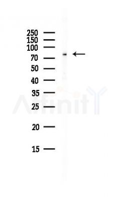 Rad17 Antibody - Western blot analysis of lysates from HepG2 cells(LPS, 4h treatment), using Rad17 Antibody at 1/1000 dilution.
