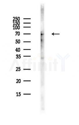 5 Lipoxygenase Antibody - Western blot analysis of lysates from COLO205 cells(heat-shock,45min treatment), using 5 Lipoxygenase Antibody at 1/1000 dilution.