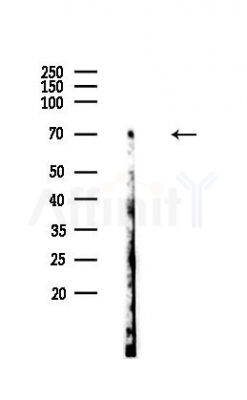 SRF Antibody - Western blot analysis of lysates from EC304 cells, using SRF Antibody at 1/1000 dilution.