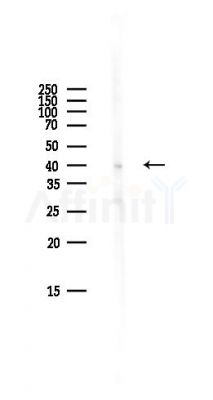 FRA1 Antibody - Western blot analysis of lysates from Mouse brain, using FRA1 Antibody at 1/1000 dilution.